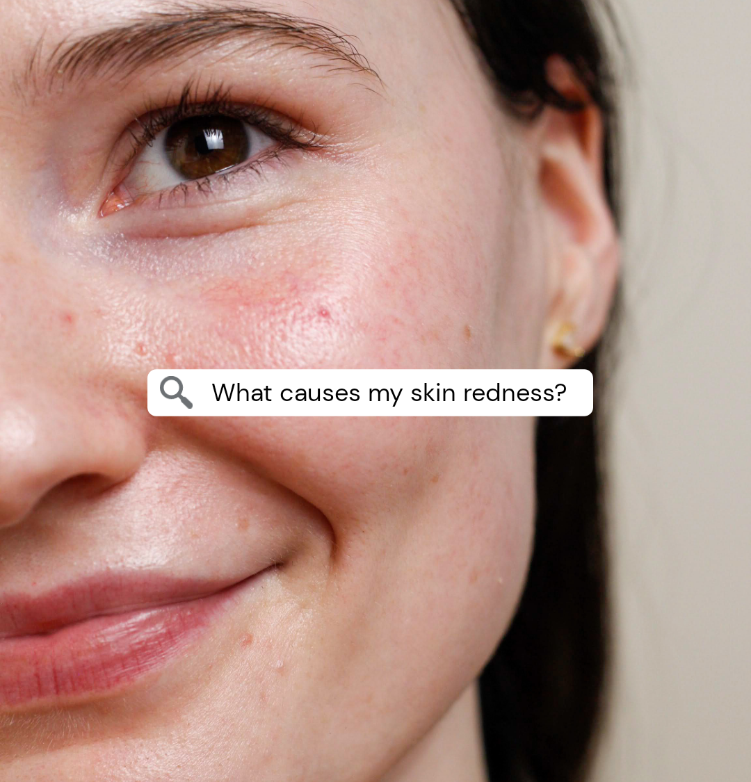 What Causes Skin Redness On Face